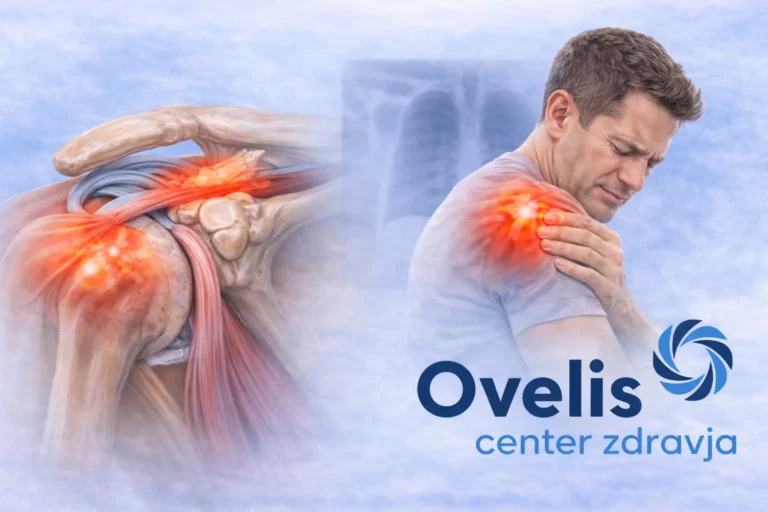 Impingement rame: anatomski prikaz vnetja tetive in balse pod akromionom z logotipom Ovelis center zdravja.