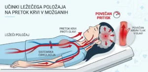prikaz povečanega pretoka krvi v glavo v ležečem položaju
