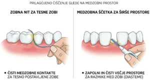 primerjava zobne niti in medzobnih ščetk